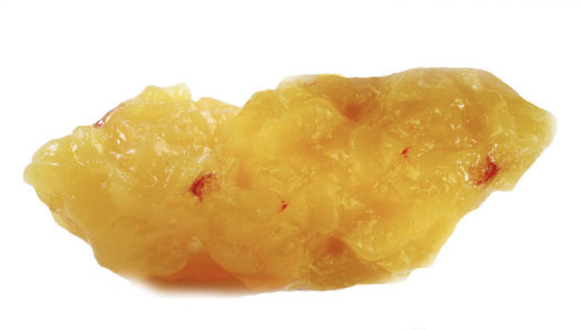 체지방 계산기 지방